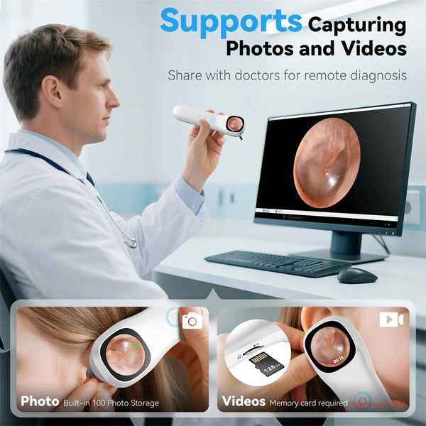 5 - in - 1 Smart Ear Detector - With Screen 1080P HD Ear Camera For Home Use - stepyours.com