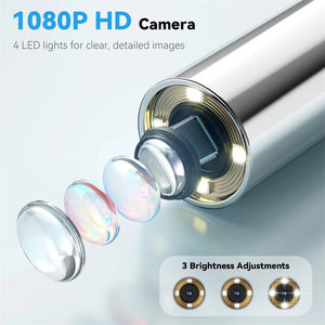 5 - in - 1 Smart Ear Detector - With Screen 1080P HD Ear Camera For Home Use - stepyours.com
