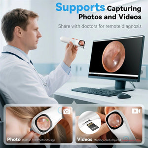 5 - in - 1 Smart Ear Detector - With Screen 1080P HD Ear Camera For Home Use - stepyours.com