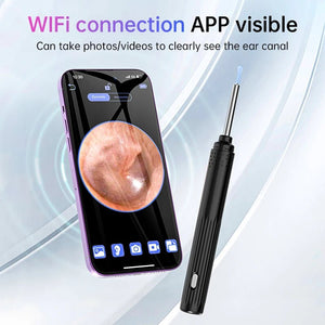 KERUI Ear Wax Removal Cleaner With 5MP HD Camera - See Ear Canal Add Hooks - stepyours.com