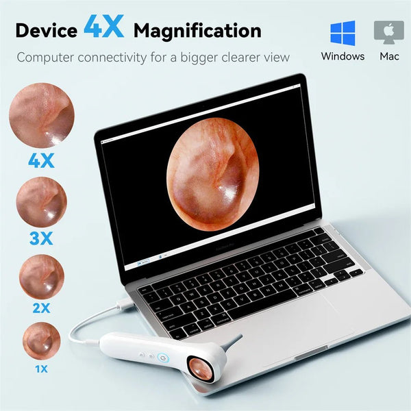 5 - in - 1 Smart Ear Detector - With Screen 1080P HD Ear Camera For Home Use - stepyours.com