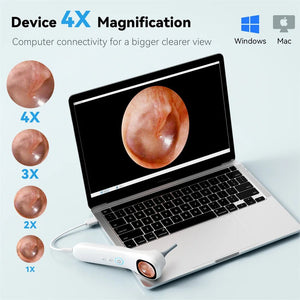 5 - in - 1 Smart Ear Detector - With Screen 1080P HD Ear Camera For Home Use - stepyours.com