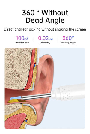 KERUI Ear Wax Removal Cleaner With 5MP HD Camera - See Ear Canal Add Hooks - stepyours.com