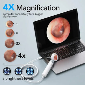 Smart Ear Camera Endoscope 90 Degree Rotatable Head With 1080P HD View 12 Heads - stepyours.com
