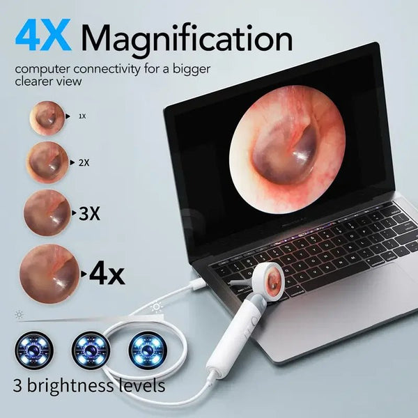 Smart Ear Camera Endoscope - 90 Degree Rotatable Head 1080P HD With 12 Heads - stepyours.com